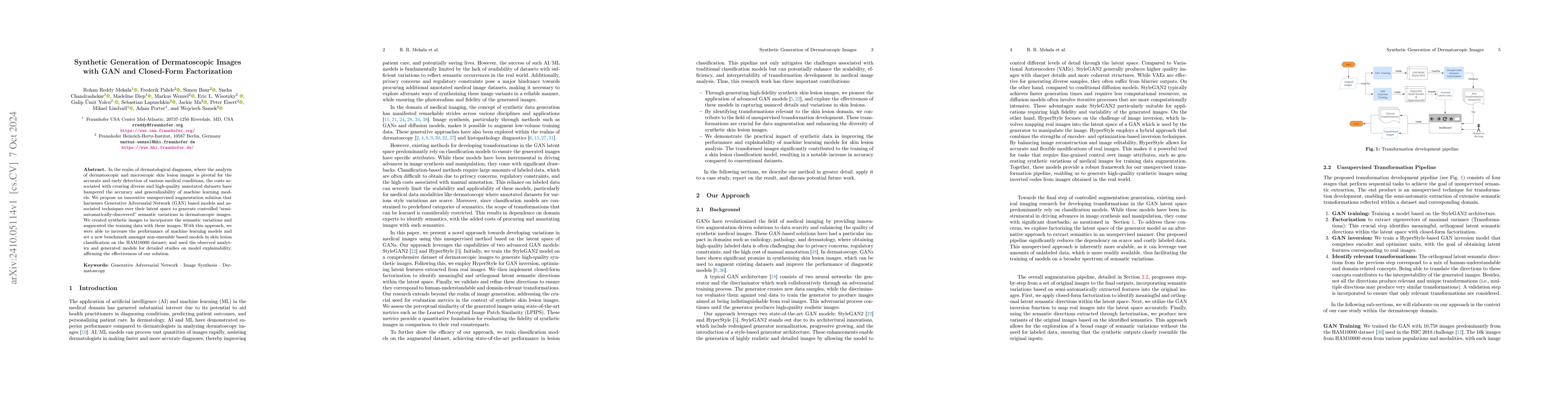 Thumbnail for Synthetic Generation of Dermatoscopic Images with GAN and Closed-Form
  Factorization