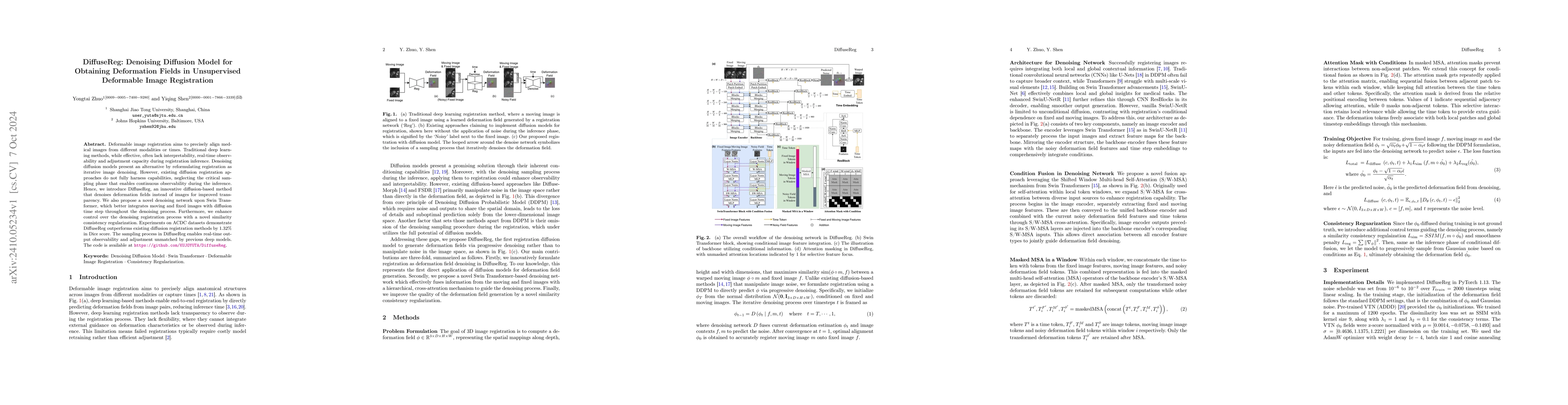Thumbnail for DiffuseReg: Denoising Diffusion Model for Obtaining Deformation Fields
  in Unsupervised Deformable Image Registration