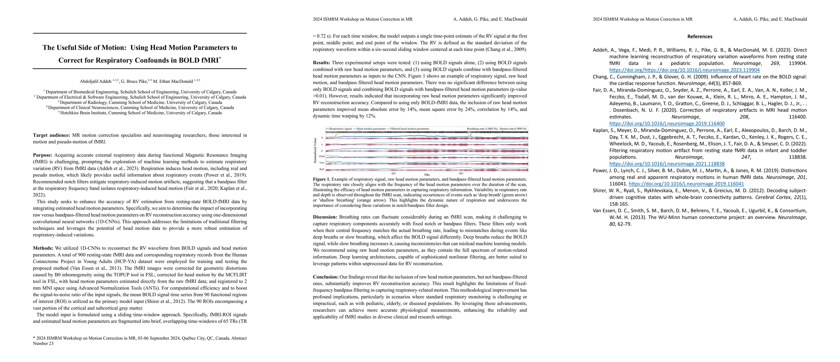 Thumbnail for The Useful Side of Motion: Using Head Motion Parameters to Correct for
  Respiratory Confounds in BOLD fMRI