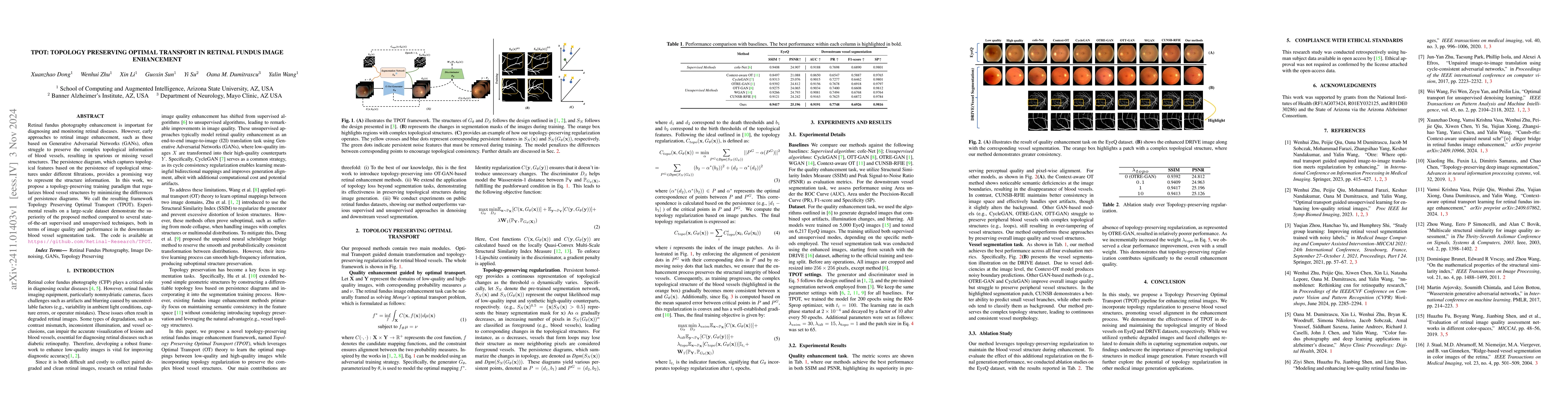 Thumbnail for TPOT: Topology Preserving Optimal Transport in Retinal Fundus Image
  Enhancement