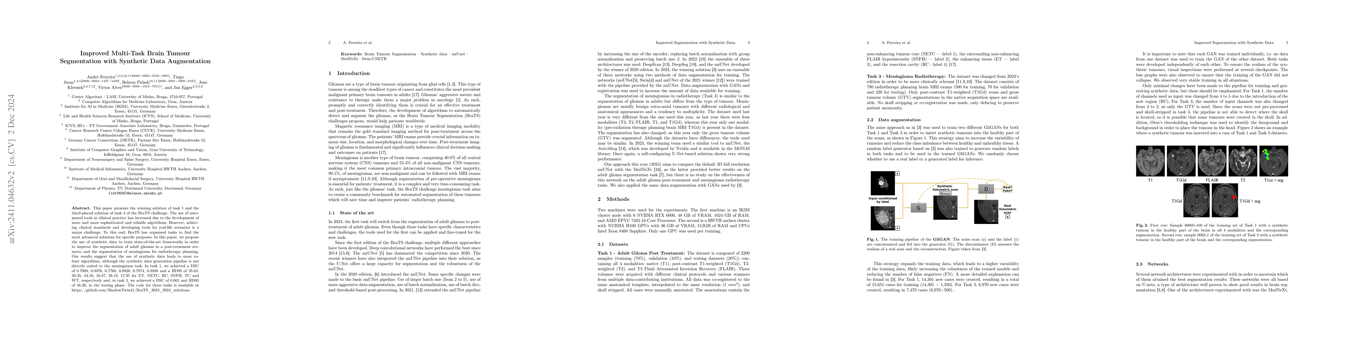 Thumbnail for Improved Multi-Task Brain Tumour Segmentation with Synthetic Data
  Augmentation