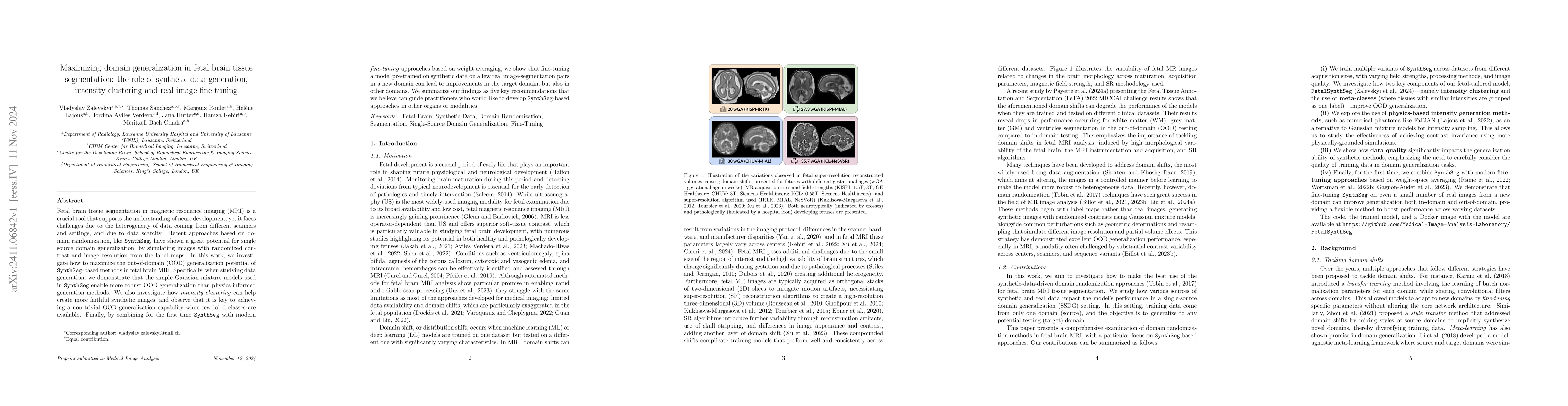 Thumbnail for Maximizing domain generalization in fetal brain tissue segmentation: the
  role of synthetic data generation, intensity clustering and real image
  fine-tuning