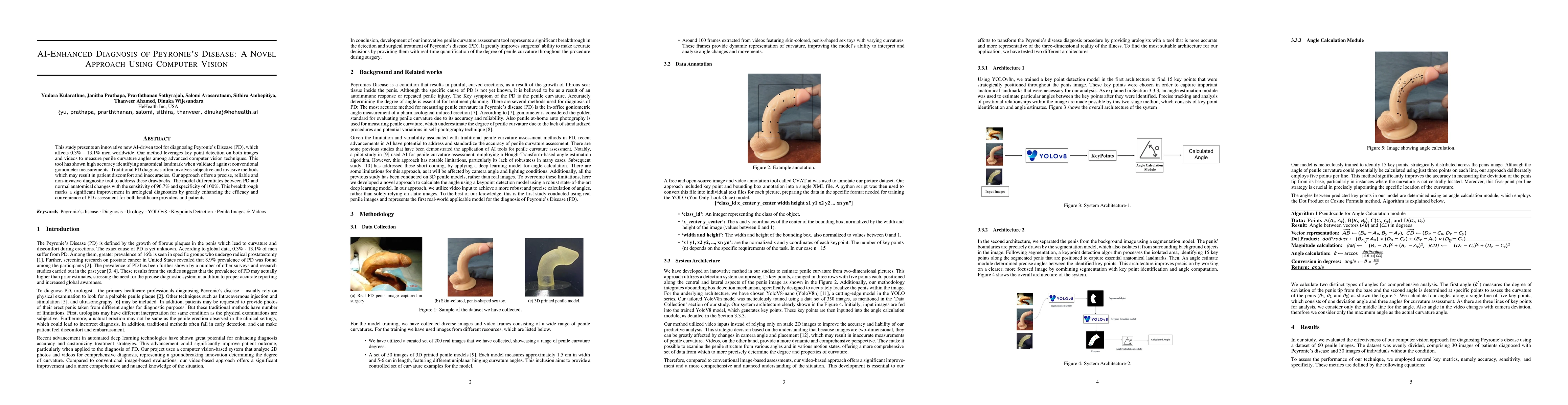 Thumbnail for AI enhanced diagnosis of Peyronies disease a novel approach using
  Computer Vision