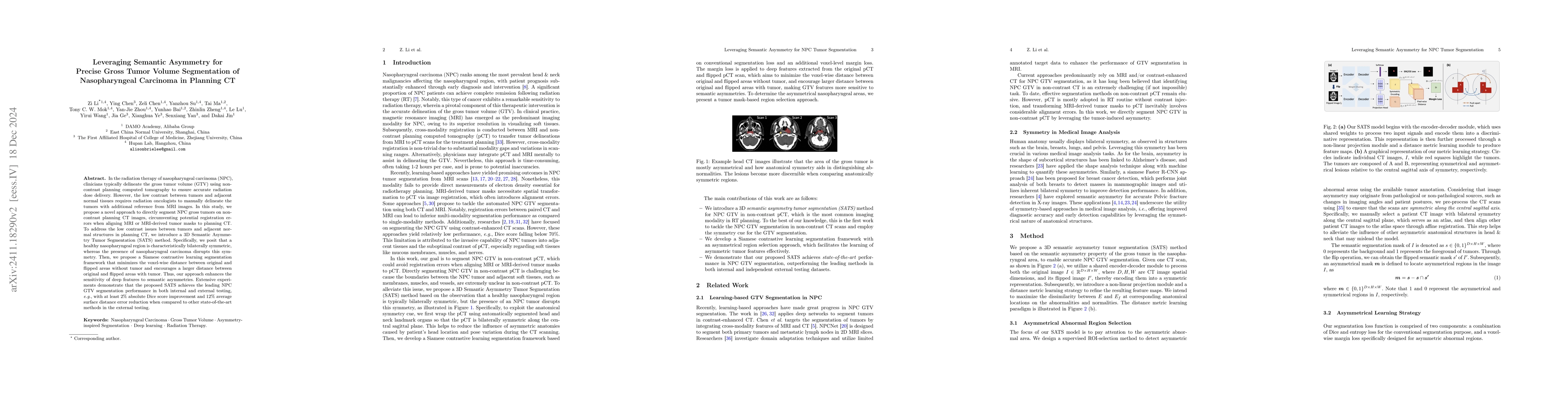Thumbnail for Leveraging Semantic Asymmetry for Precise Gross Tumor Volume
  Segmentation of Nasopharyngeal Carcinoma in Planning CT