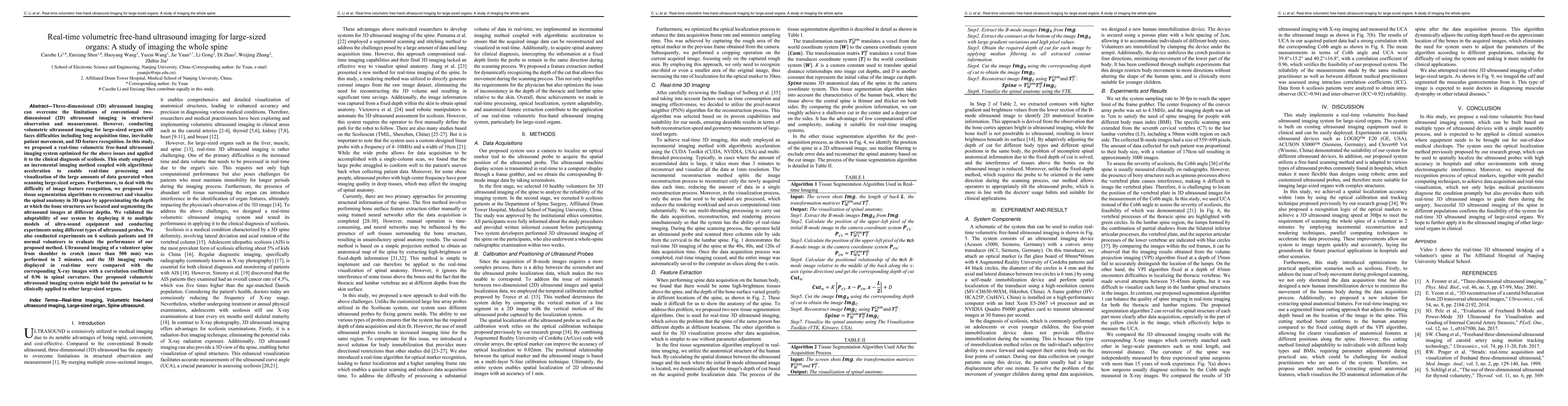 Thumbnail for Real-time volumetric free-hand ultrasound imaging for large-sized
  organs: A study of imaging the whole spine