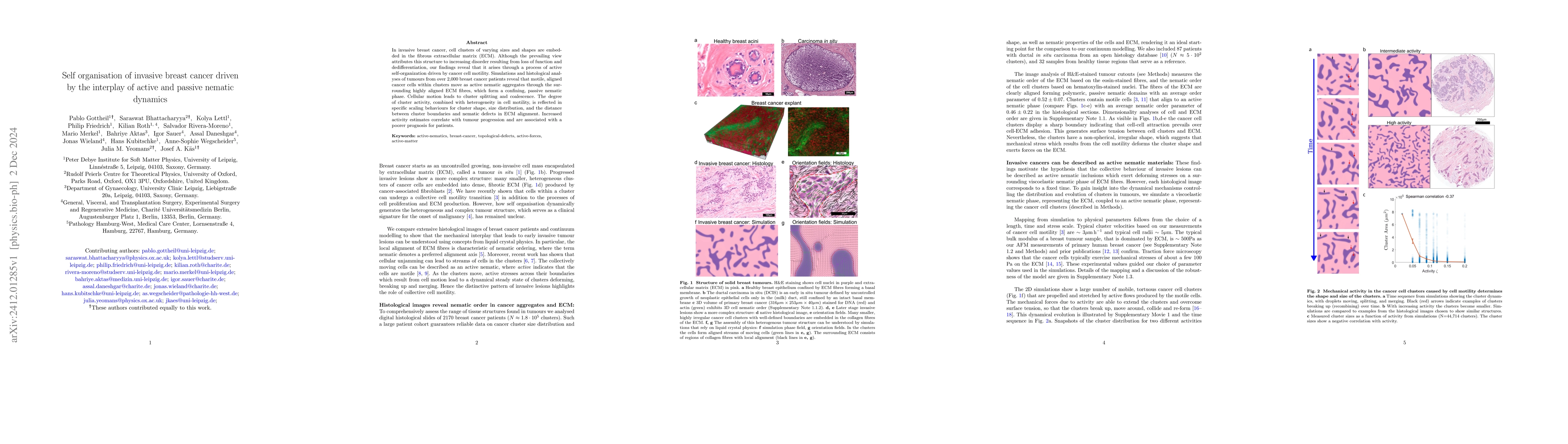Thumbnail for Self organisation of invasive breast cancer driven by the interplay of
  active and passive nematic dynamics