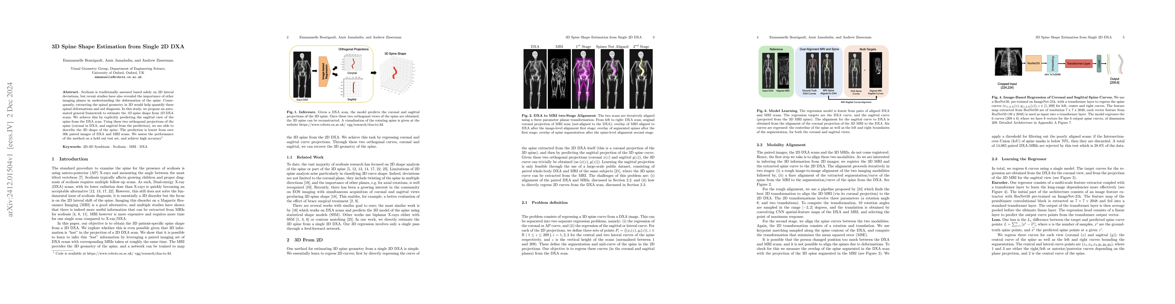 Thumbnail for 3D Spine Shape Estimation from Single 2D DXA