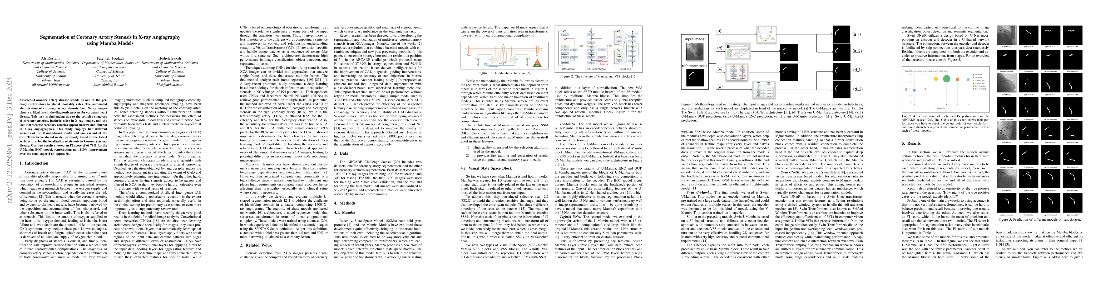 Thumbnail for Segmentation of Coronary Artery Stenosis in X-ray Angiography using
  Mamba Models