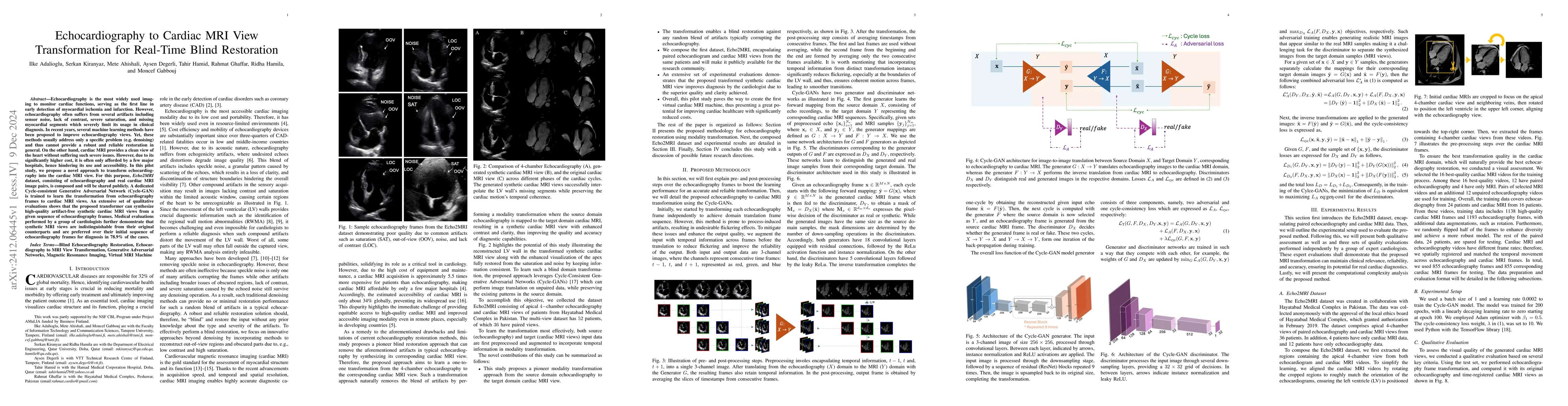 Thumbnail for Echocardiography to Cardiac MRI View Transformation for Real-Time Blind
  Restoration