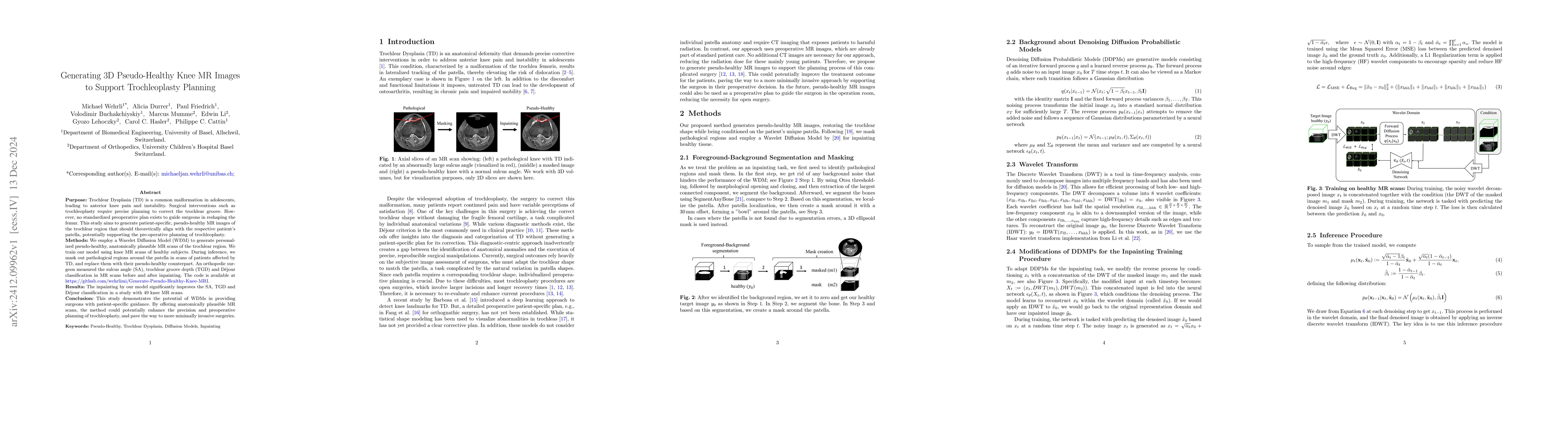 Thumbnail for Generating 3D Pseudo-Healthy Knee MR Images to Support Trochleoplasty
  Planning