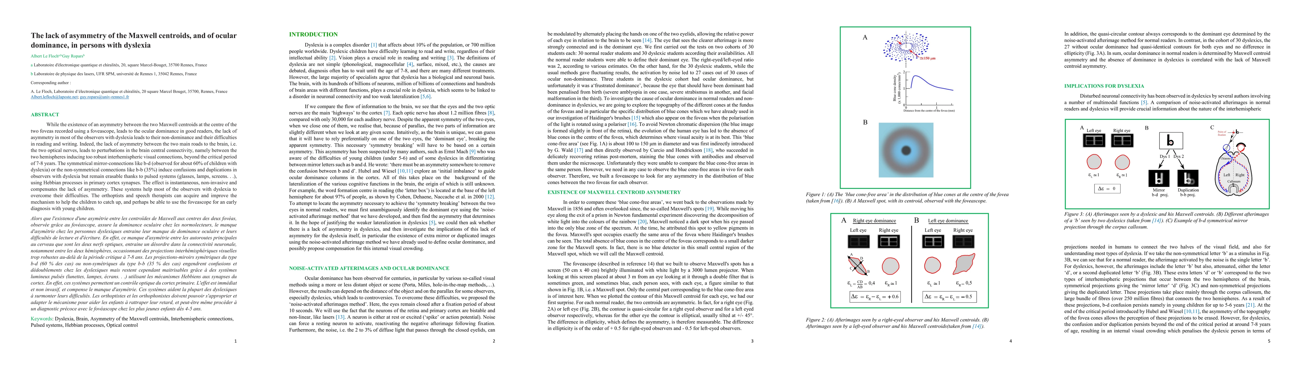 Thumbnail for The lack of asymmetry of the Maxwell centroids, and of ocular dominance,
  in persons with dyslexia