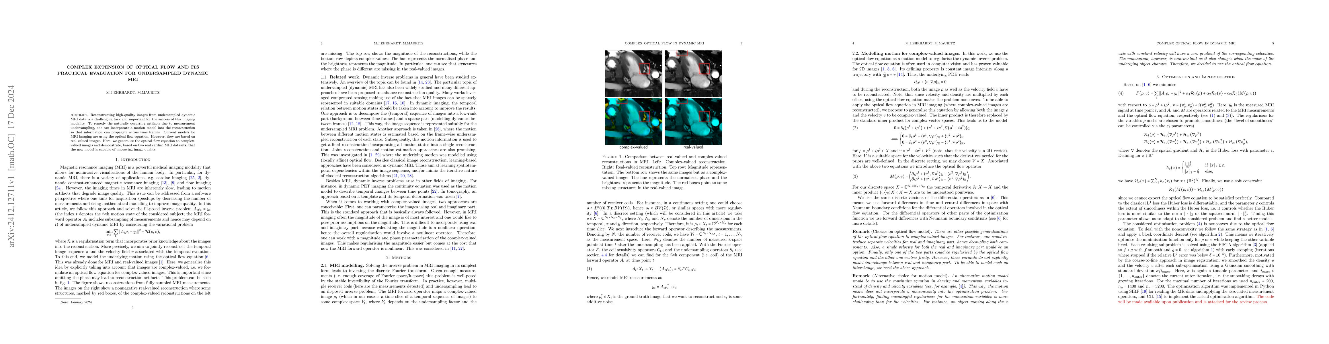 Thumbnail for Complex extension of optical flow and its practical evaluation for
  undersampled dynamic MRI