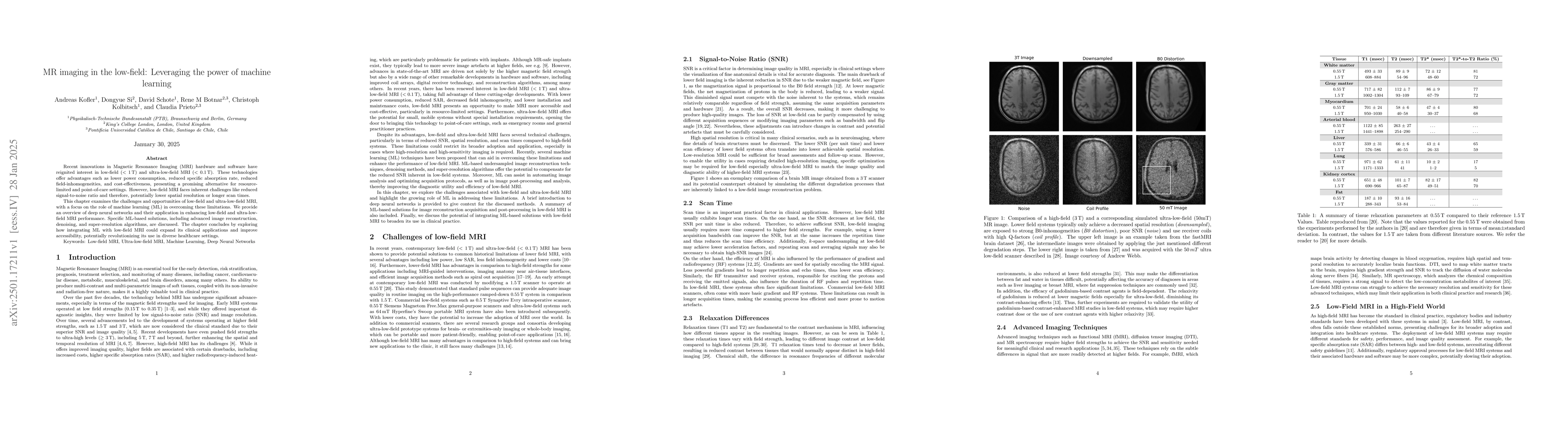 Thumbnail for MR imaging in the low-field: Leveraging the power of machine learning