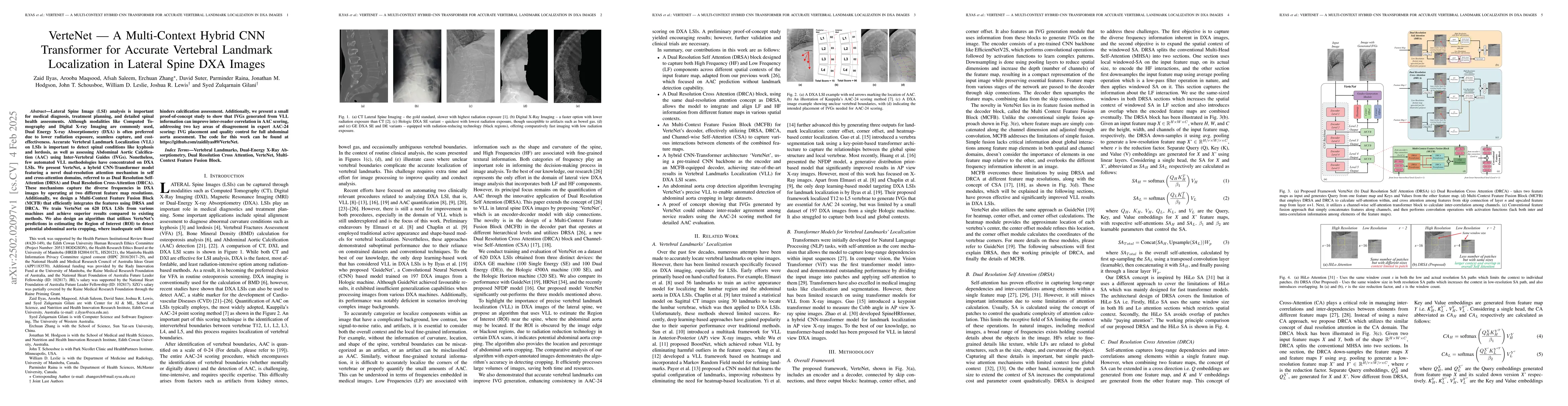 Thumbnail for VerteNet -- A Multi-Context Hybrid CNN Transformer for Accurate
  Vertebral Landmark Localization in Lateral Spine DXA Images