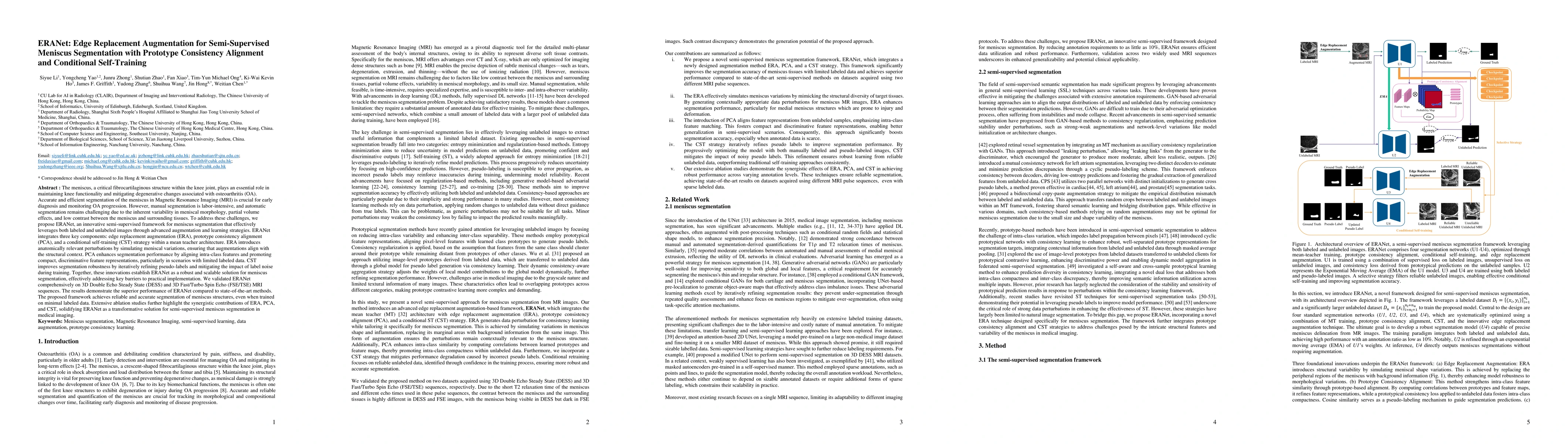 Thumbnail for ERANet: Edge Replacement Augmentation for Semi-Supervised Meniscus
  Segmentation with Prototype Consistency Alignment and Conditional
  Self-Training