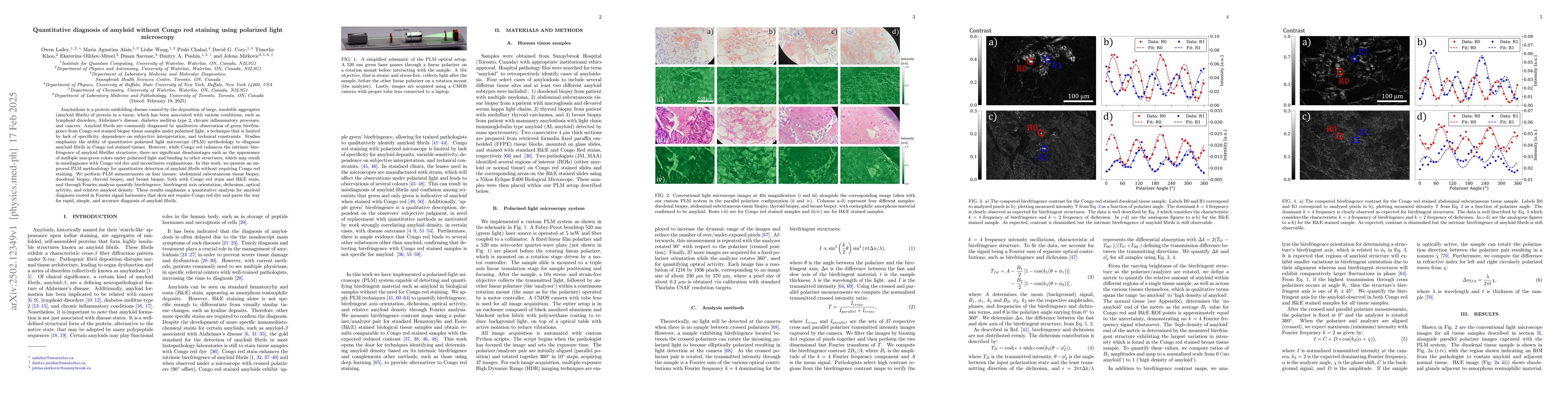 Thumbnail for Quantitative diagnosis of amyloid without Congo red staining using
  polarized light microscopy