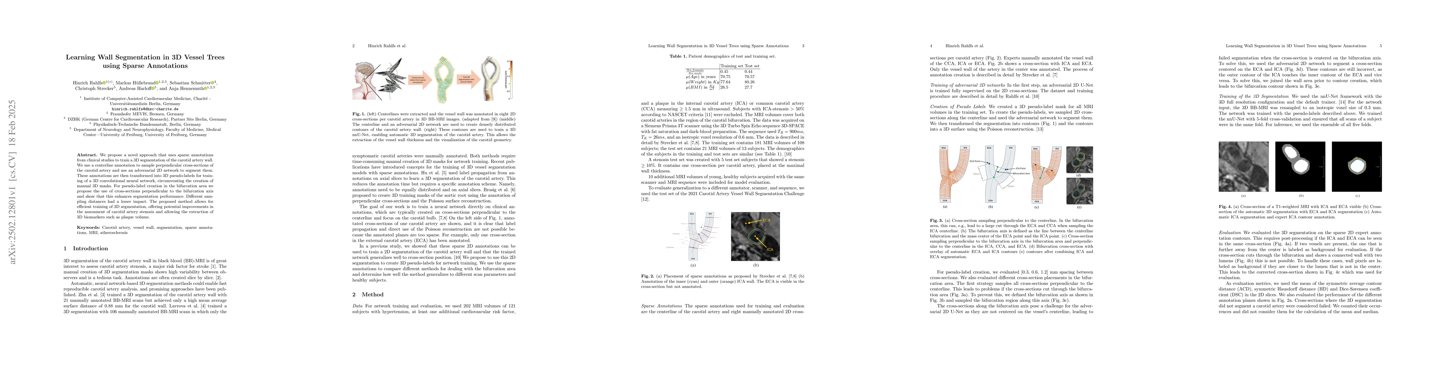 Thumbnail for Learning Wall Segmentation in 3D Vessel Trees using Sparse Annotations