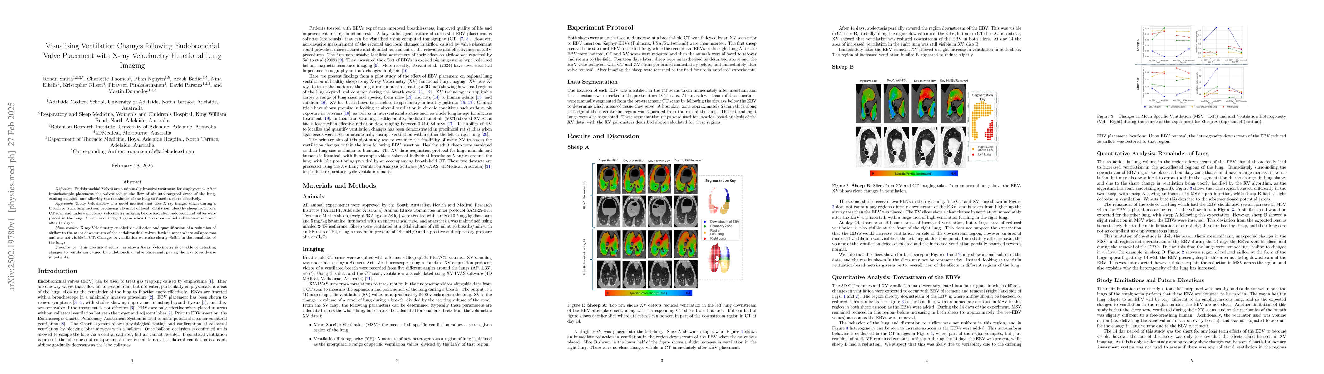 Thumbnail for Visualising Ventilation Changes following Endobronchial Valve Placement
  with X-ray Velocimetry Functional Lung Imaging