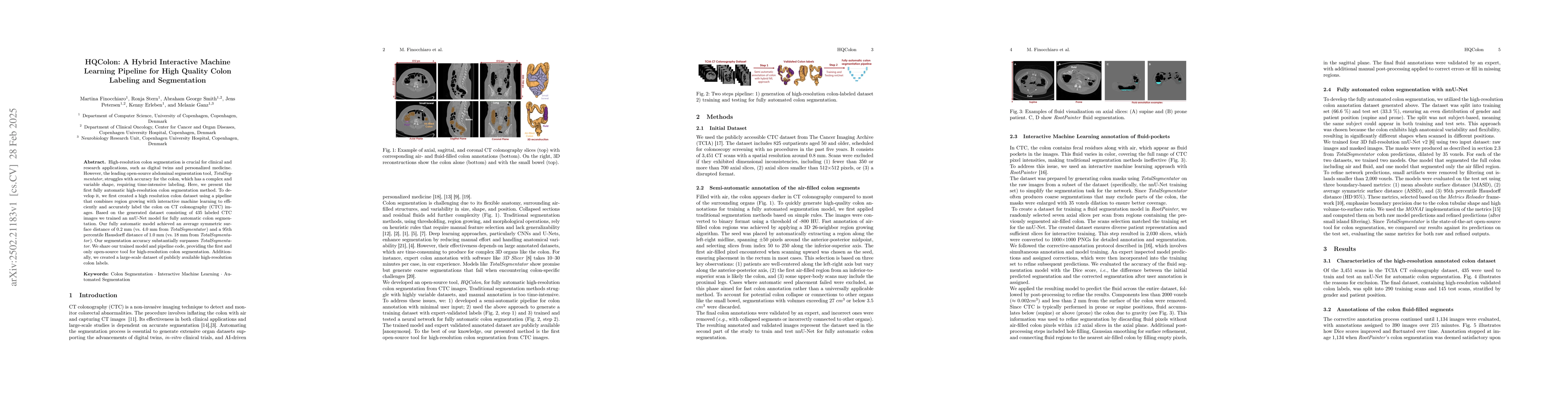 Thumbnail for HQColon: A Hybrid Interactive Machine Learning Pipeline for High Quality
  Colon Labeling and Segmentation