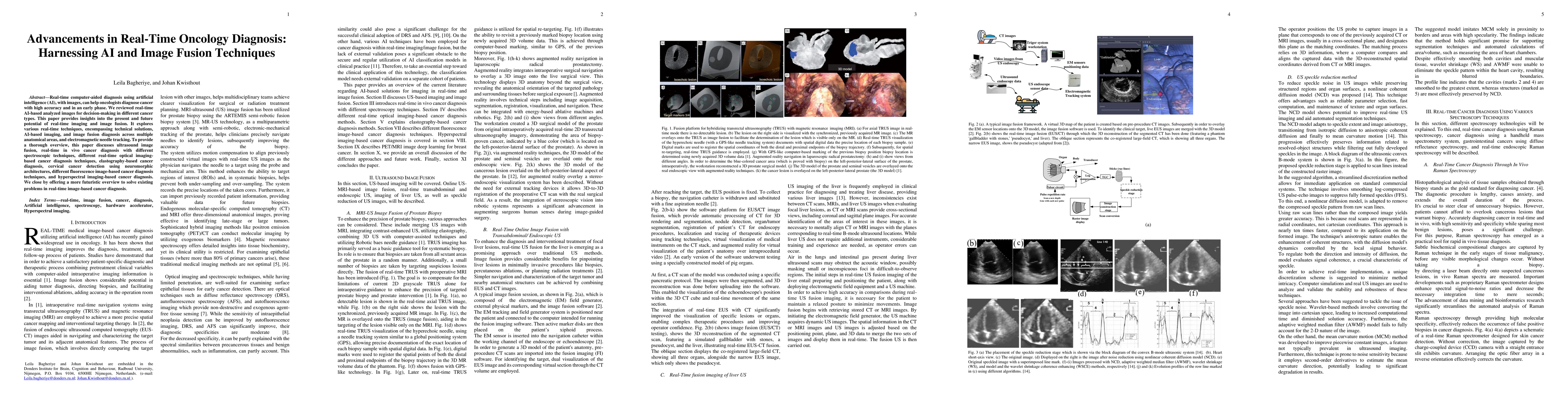 Thumbnail for Advancements in Real-Time Oncology Diagnosis: Harnessing AI and Image
  Fusion Techniques