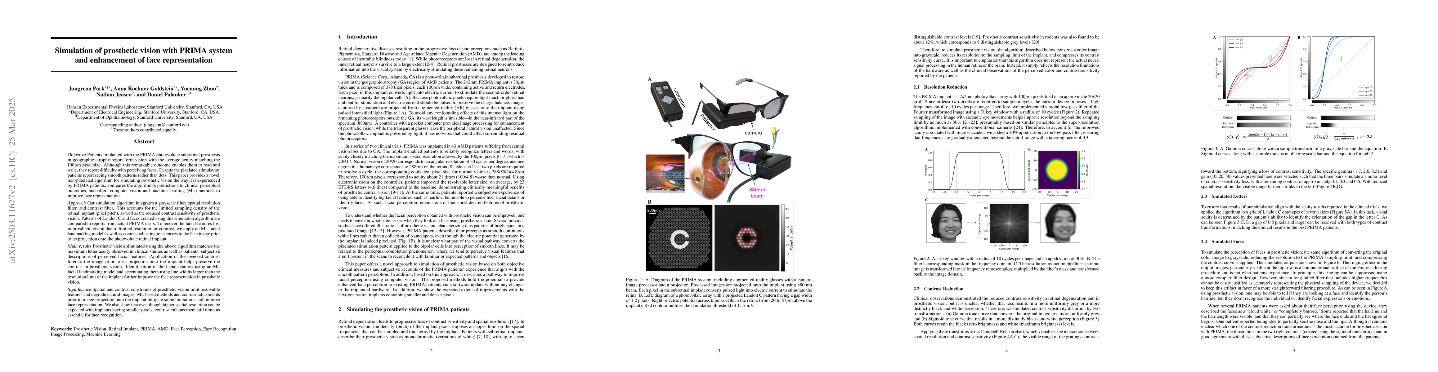 Thumbnail for Simulation of prosthetic vision with PRIMA system and enhancement of
  face representation