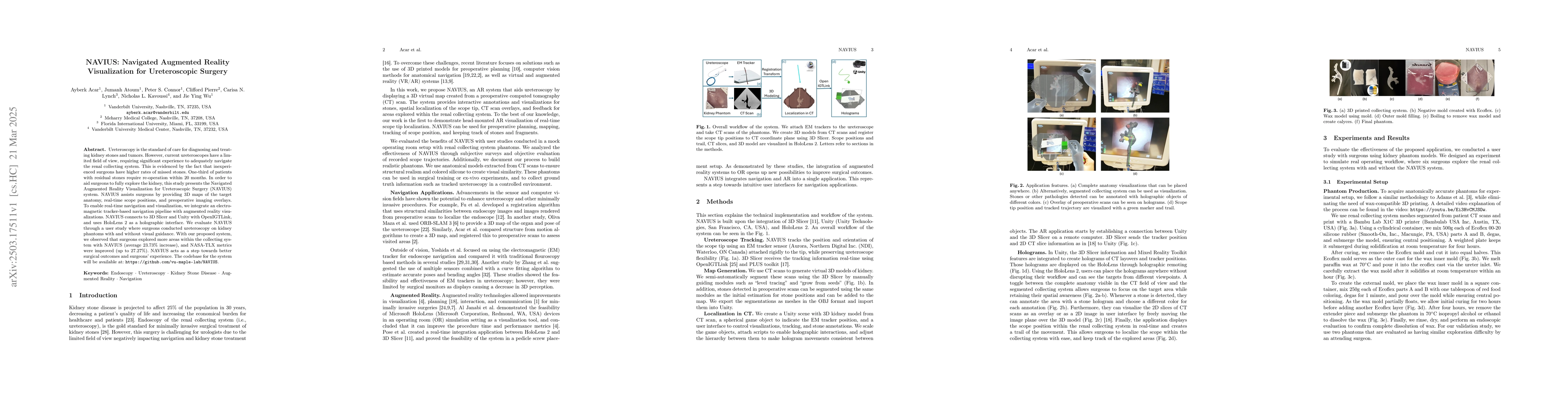Thumbnail for NAVIUS: Navigated Augmented Reality Visualization for Ureteroscopic
  Surgery