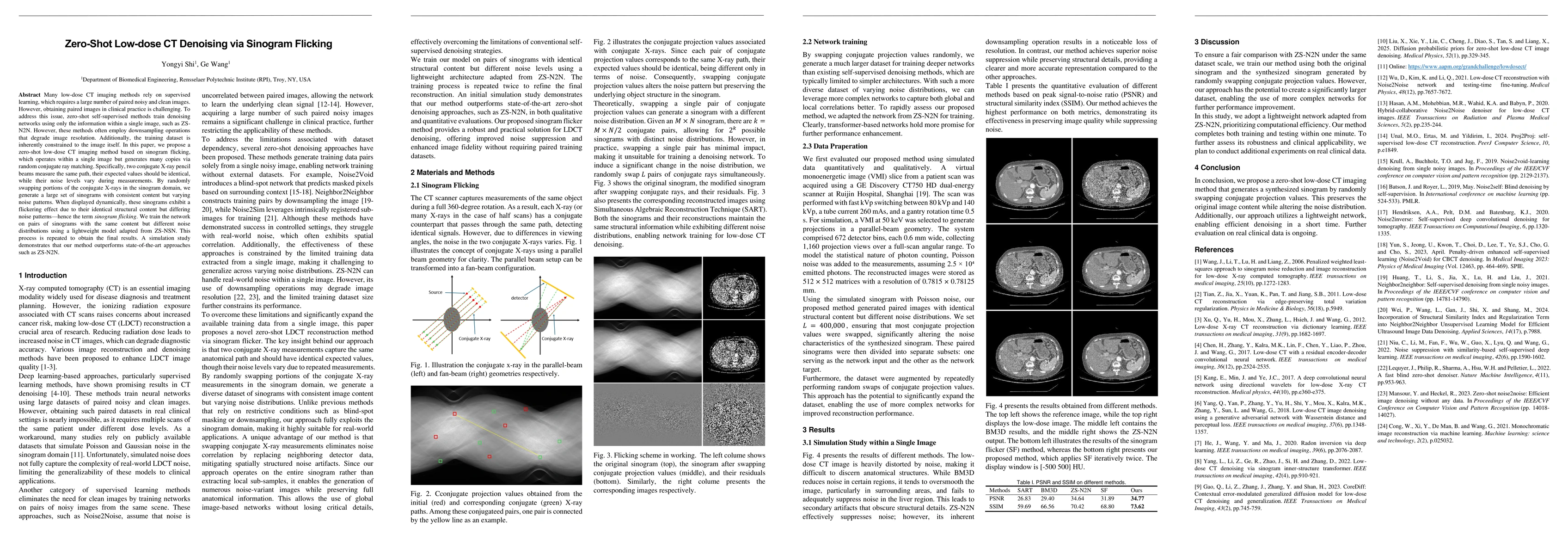 Thumbnail for Zero-Shot Low-dose CT Denoising via Sinogram Flicking