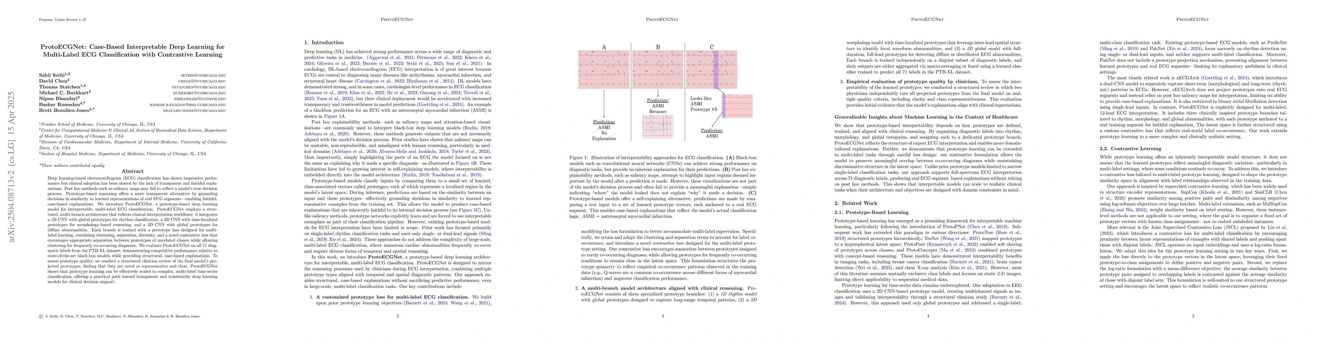 Thumbnail for ProtoECGNet: Case-Based Interpretable Deep Learning for Multi-Label ECG
  Classification with Contrastive Learning