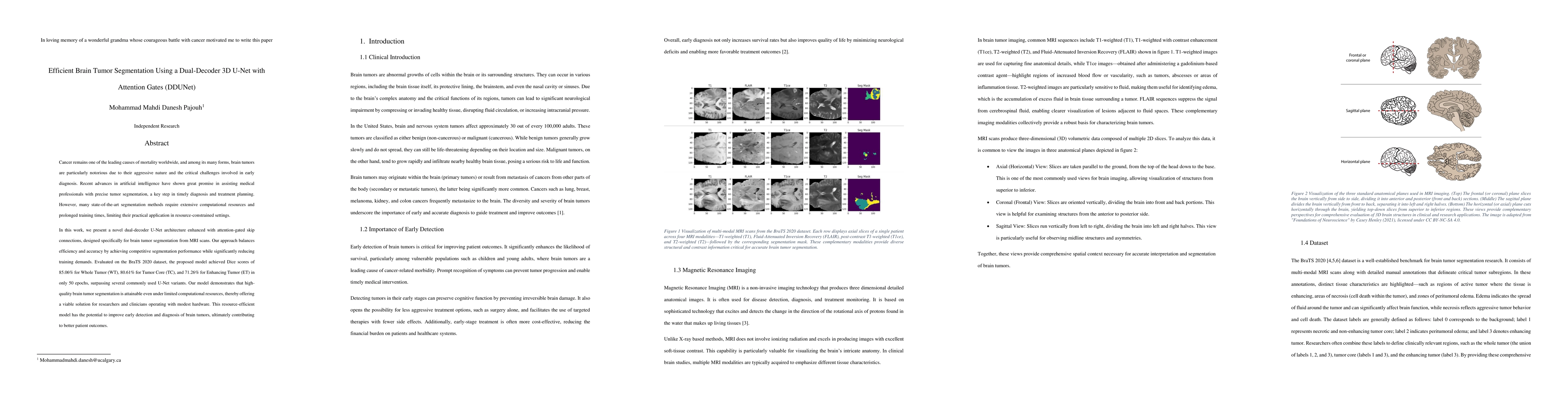 Thumbnail for Efficient Brain Tumor Segmentation Using a Dual-Decoder 3D U-Net with
  Attention Gates (DDUNet)