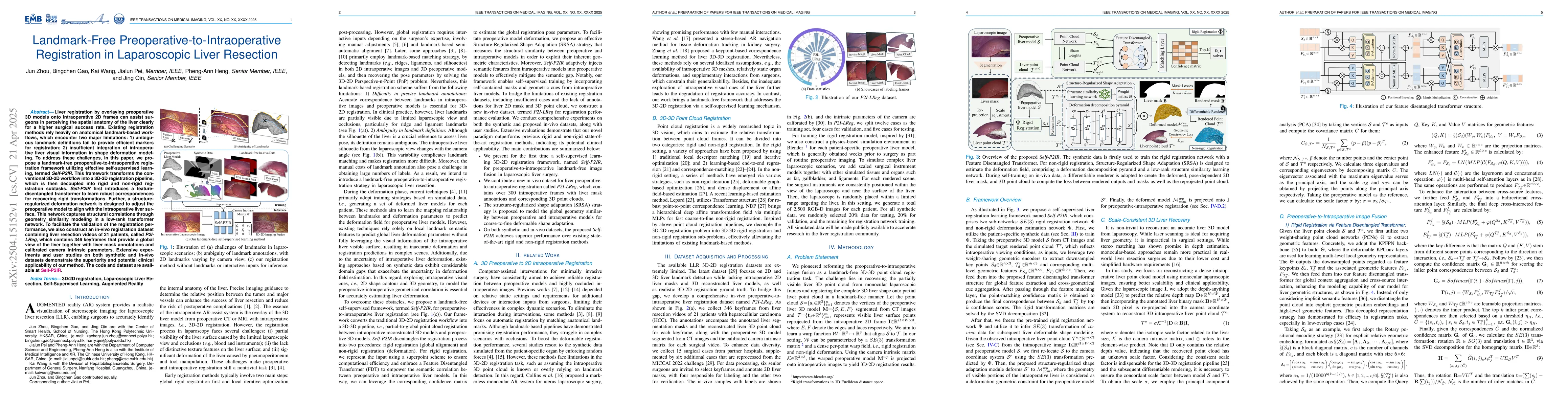 Thumbnail for Landmark-Free Preoperative-to-Intraoperative Registration in
  Laparoscopic Liver Resection