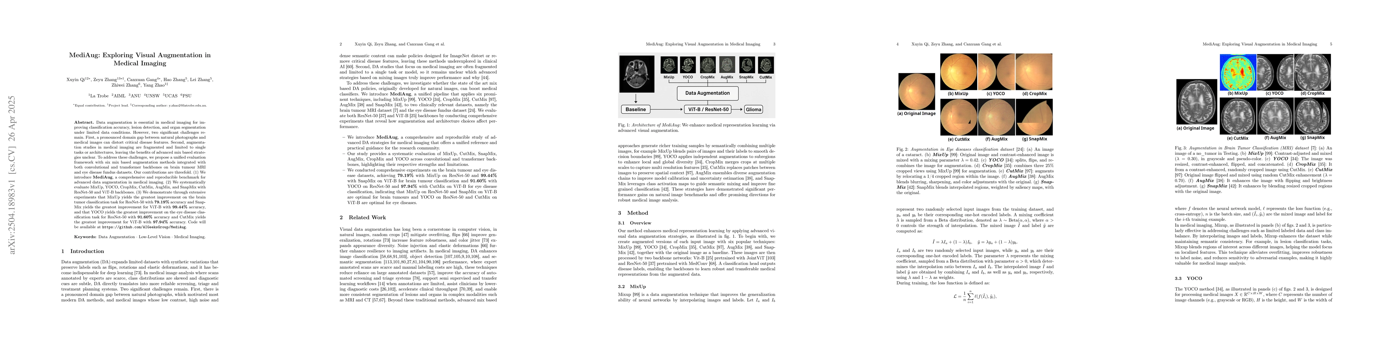 Thumbnail for MediAug: Exploring Visual Augmentation in Medical Imaging