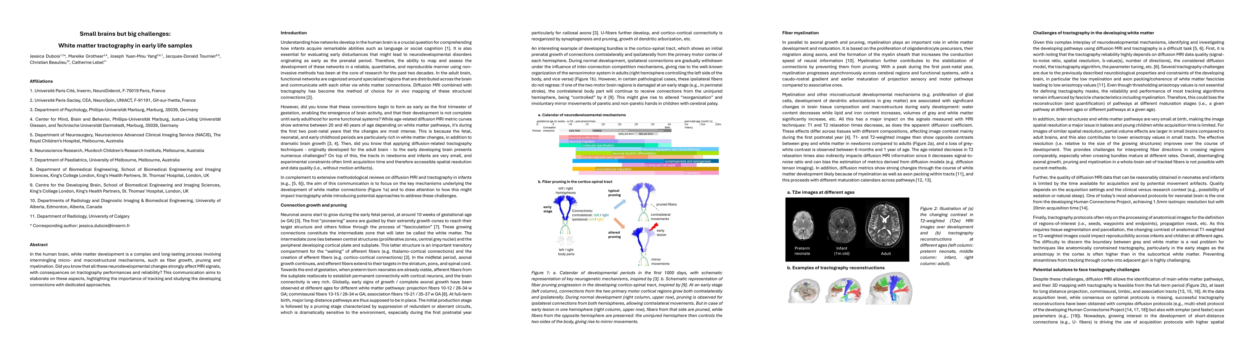 Thumbnail for Small brains but big challenges: white matter tractography in early life
  samples