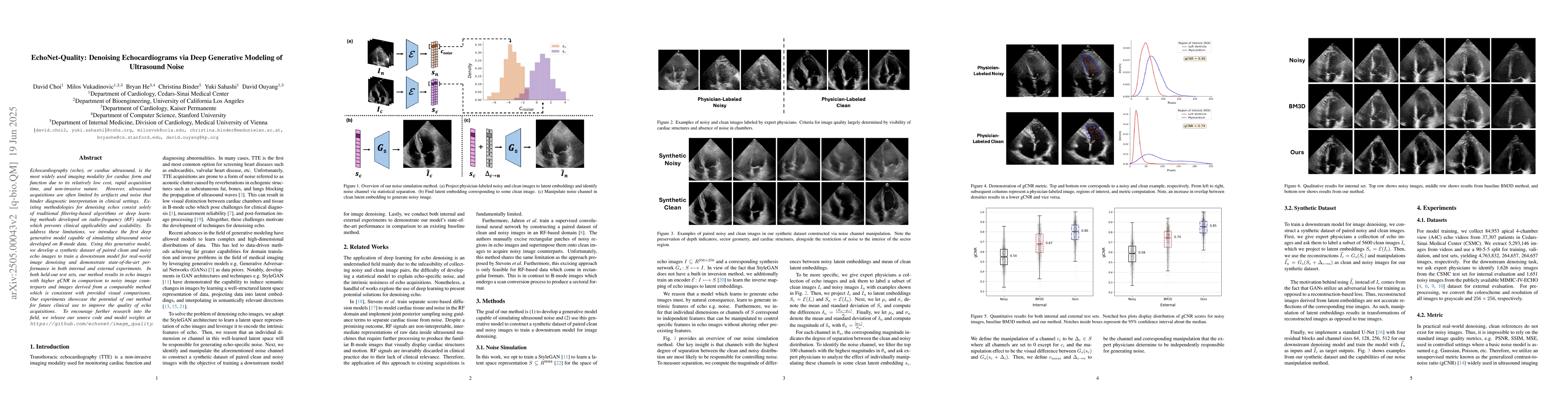 Thumbnail for Enhancing Echocardiogram Video Quality via Latent Space Editing