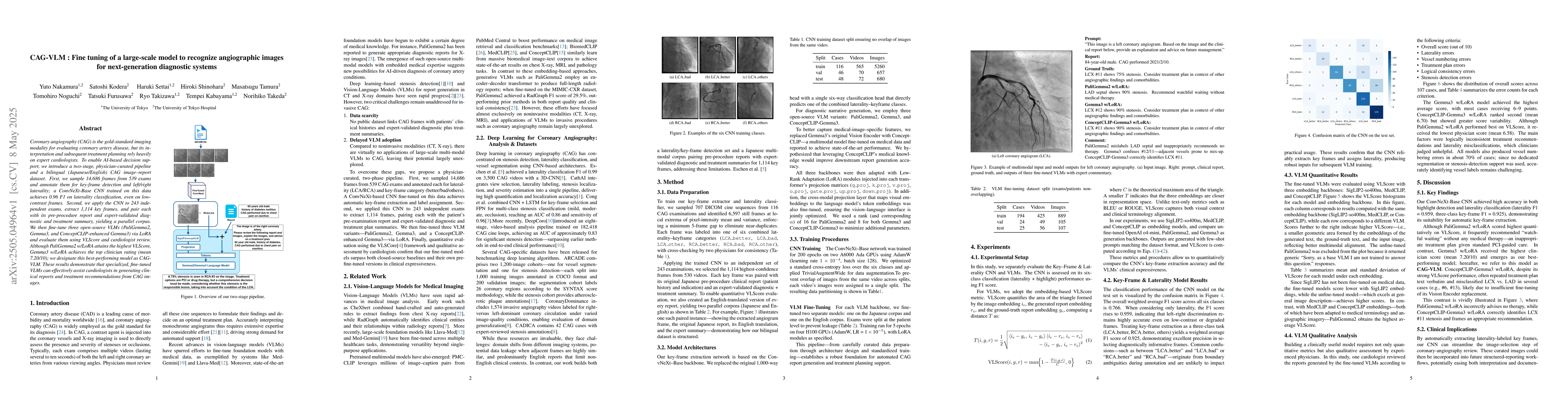 Thumbnail for CAG-VLM: Fine-Tuning of a Large-Scale Model to Recognize Angiographic
  Images for Next-Generation Diagnostic Systems