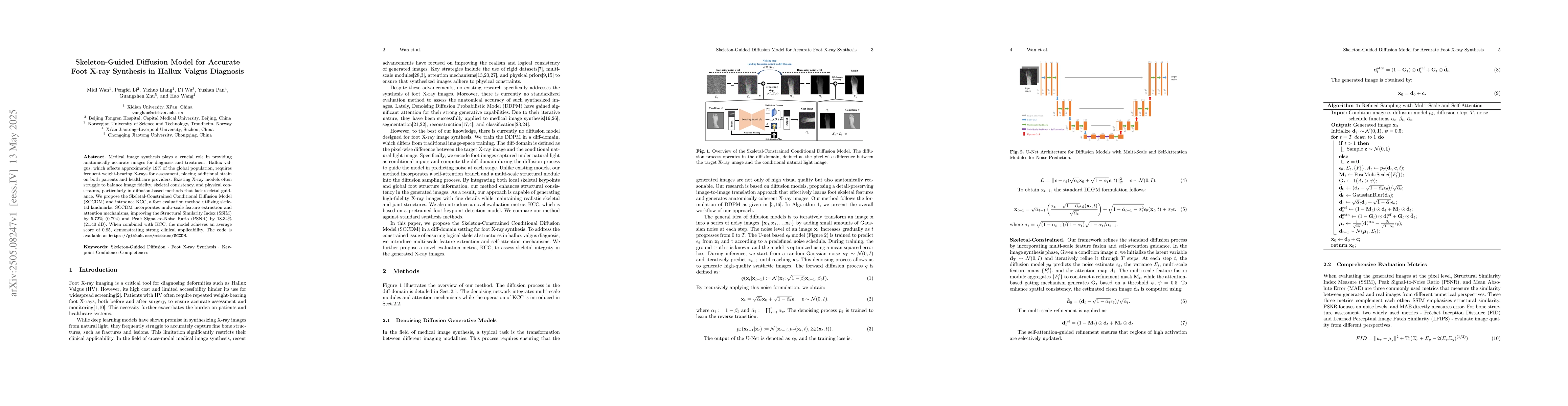 Thumbnail for Skeleton-Guided Diffusion Model for Accurate Foot X-ray Synthesis in
  Hallux Valgus Diagnosis