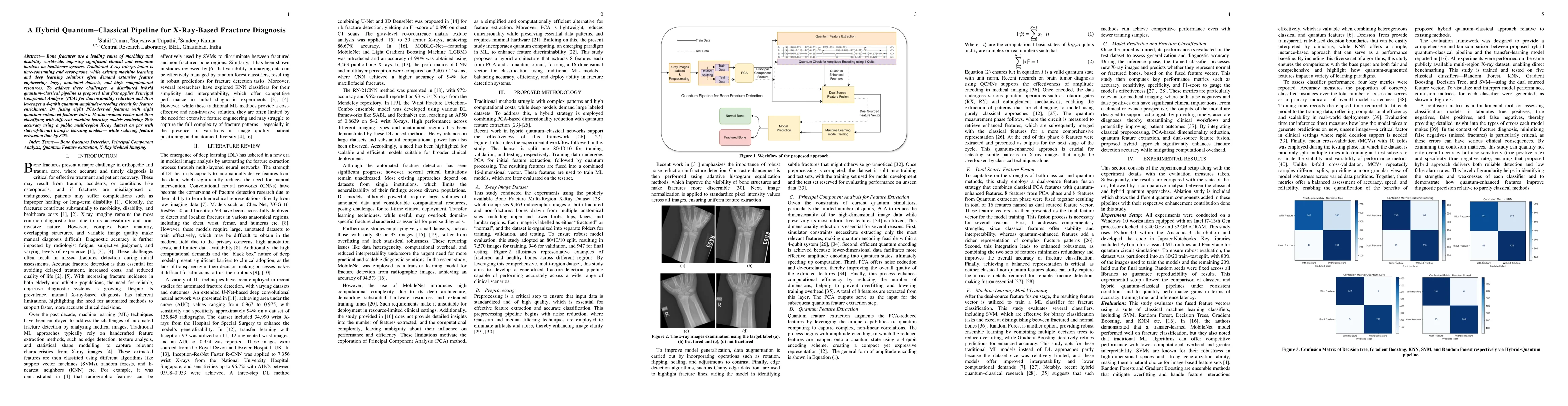 Thumbnail for A Hybrid Quantum Classical Pipeline for X Ray Based Fracture Diagnosis