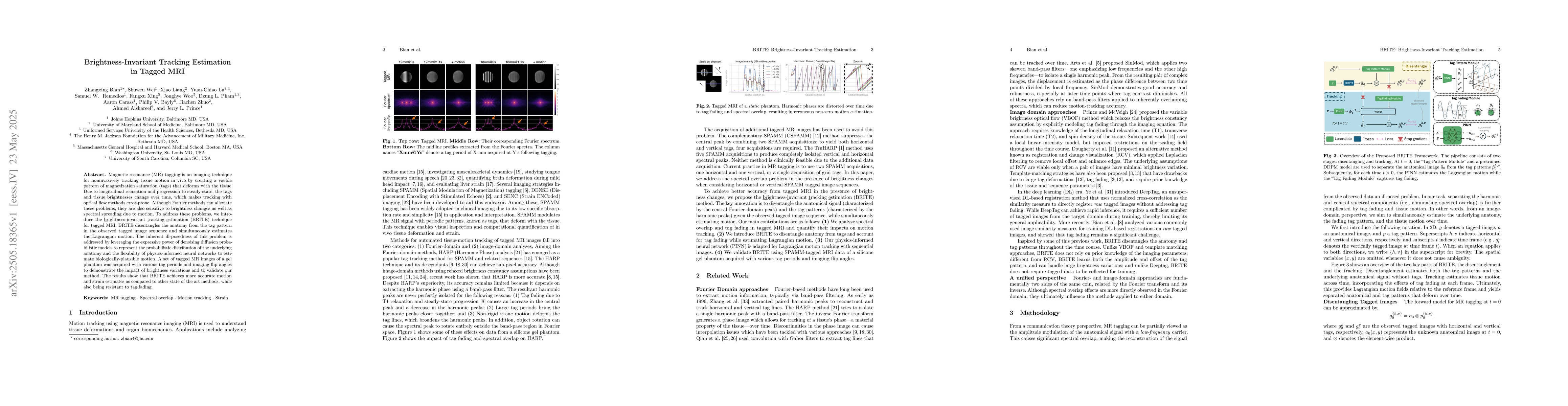 Thumbnail for Brightness-Invariant Tracking Estimation in Tagged MRI