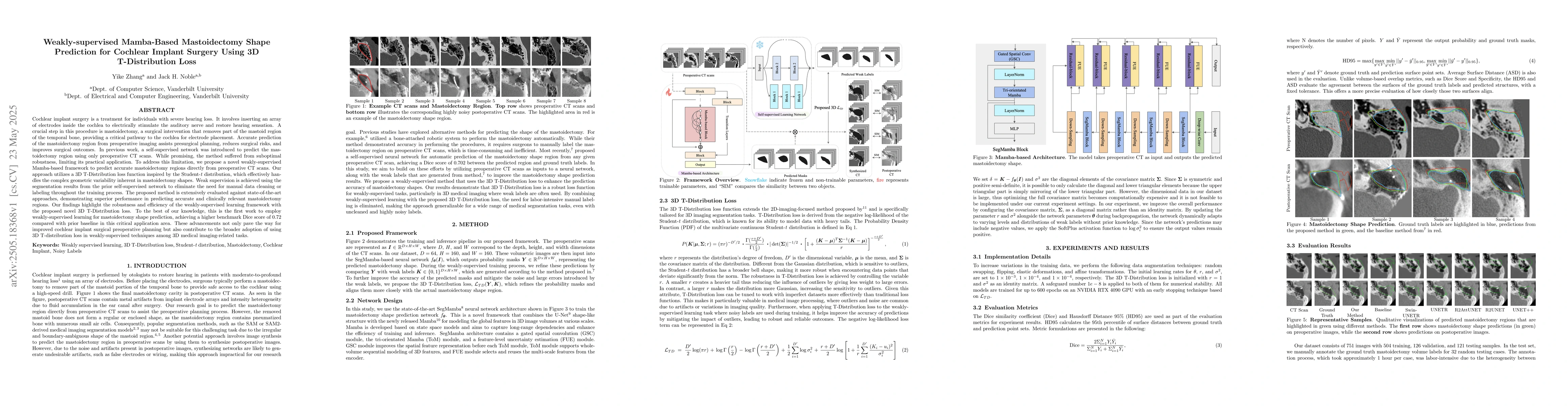 Thumbnail for Weakly-supervised Mamba-Based Mastoidectomy Shape Prediction for
  Cochlear Implant Surgery Using 3D T-Distribution Loss