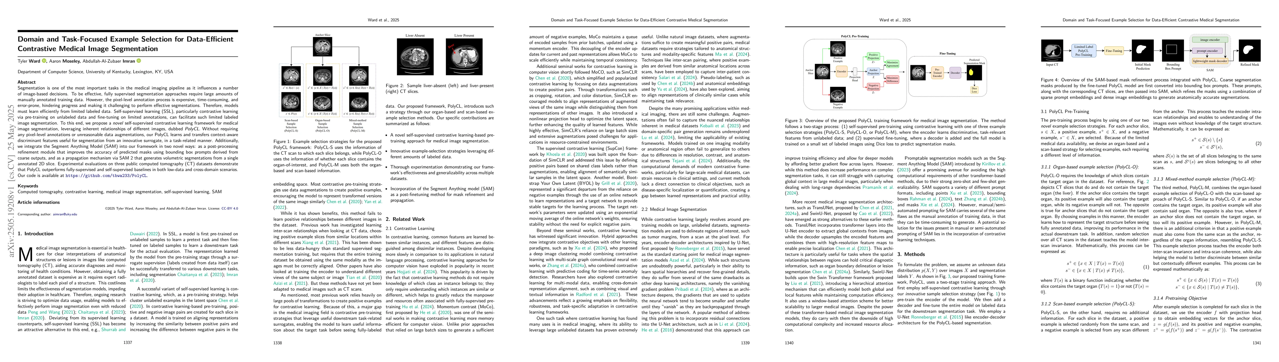 Thumbnail for Domain and Task-Focused Example Selection for Data-Efficient Contrastive
  Medical Image Segmentation