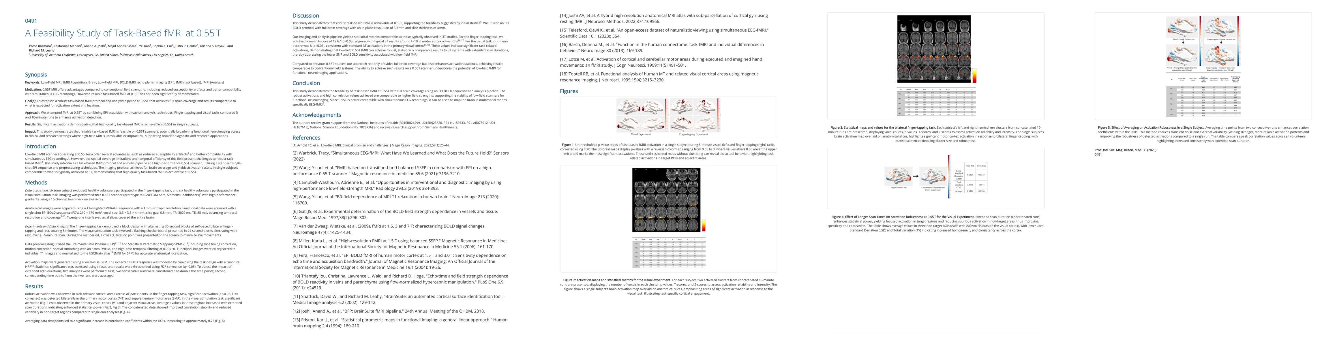 Thumbnail for A Feasibility Study of Task-Based fMRI at 0.55 T