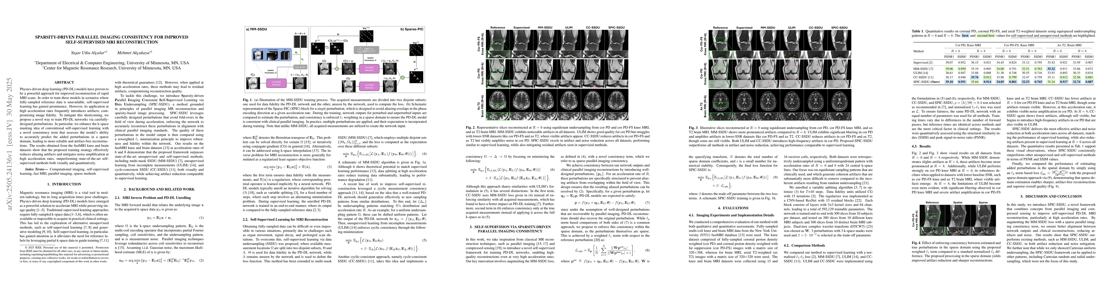 Thumbnail for Sparsity-Driven Parallel Imaging Consistency for Improved
  Self-Supervised MRI Reconstruction