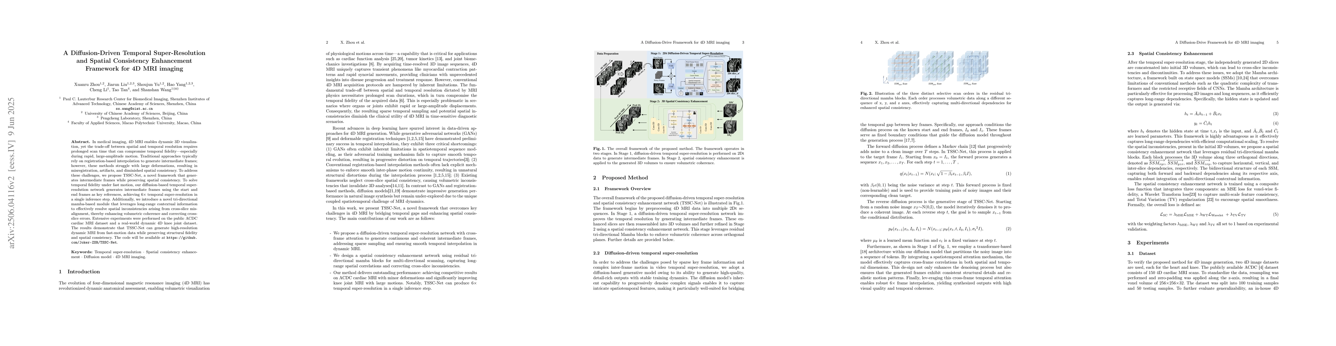 Thumbnail for A Diffusion-Driven Temporal Super-Resolution and Spatial Consistency
  Enhancement Framework for 4D MRI imaging