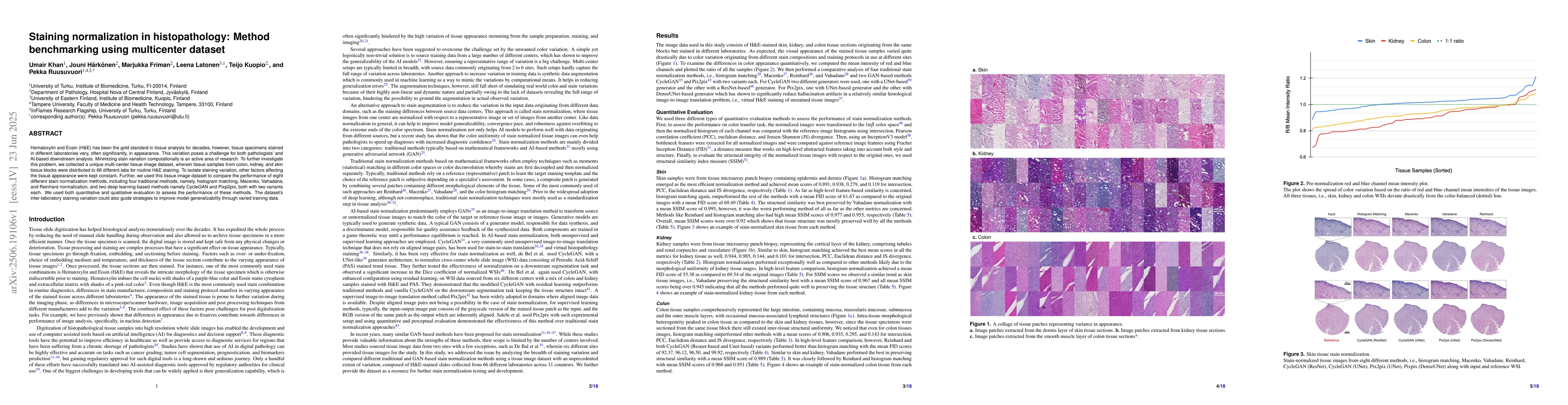 Thumbnail for Staining normalization in histopathology: Method benchmarking using
  multicenter dataset