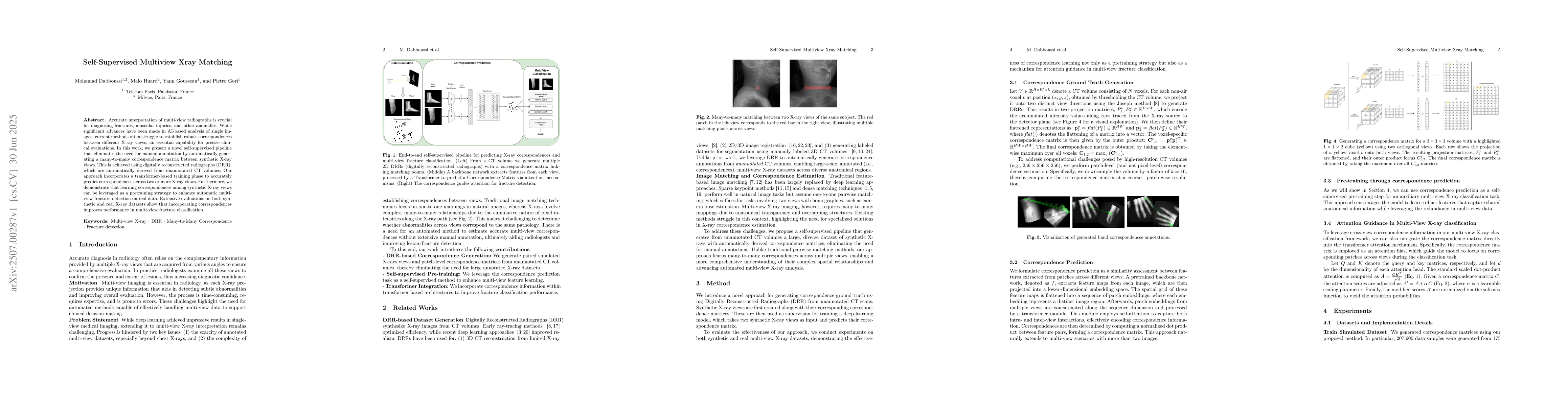 Thumbnail for Self-Supervised Multiview Xray Matching