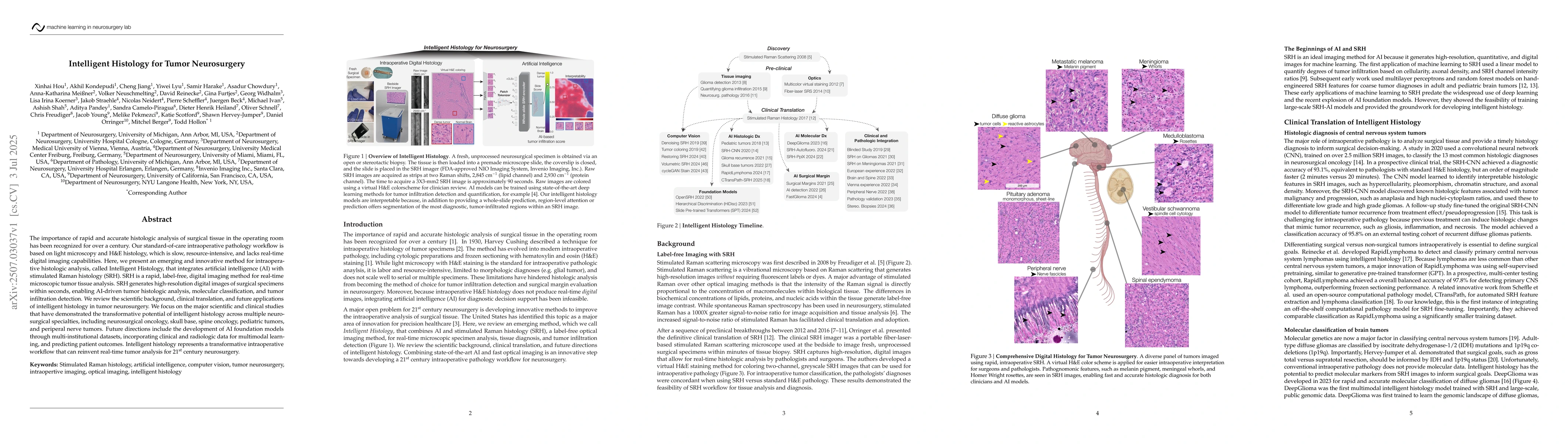 Thumbnail for Intelligent Histology for Tumor Neurosurgery