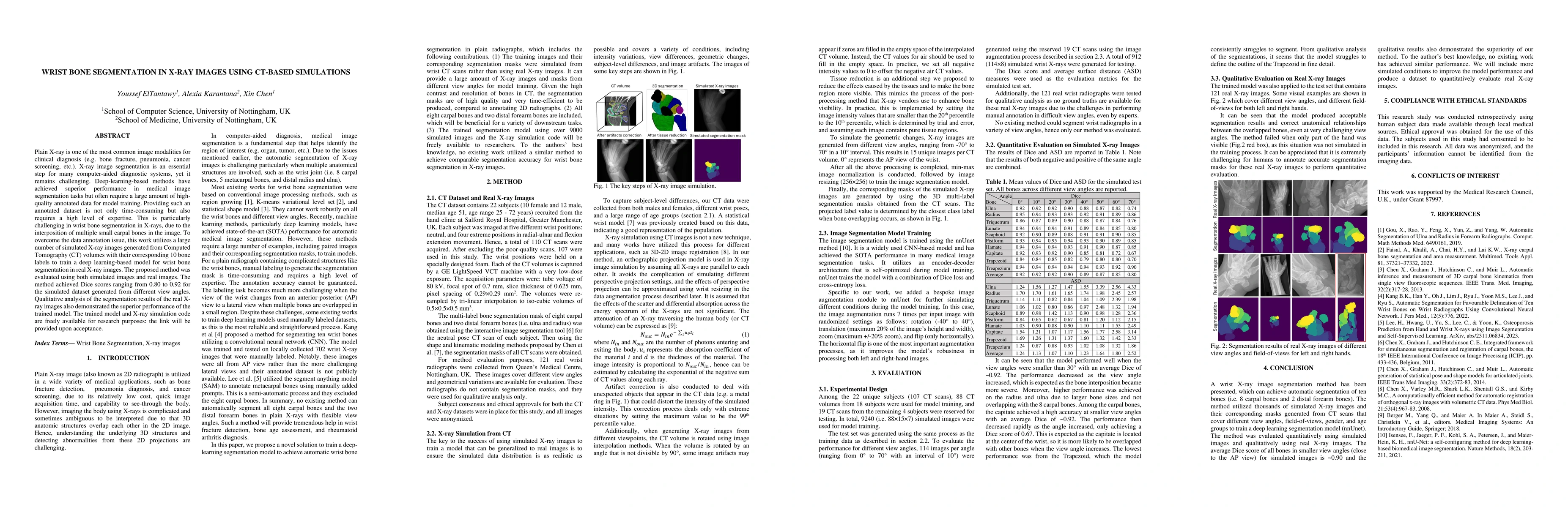 Thumbnail for Wrist bone segmentation in X-ray images using CT-based simulations