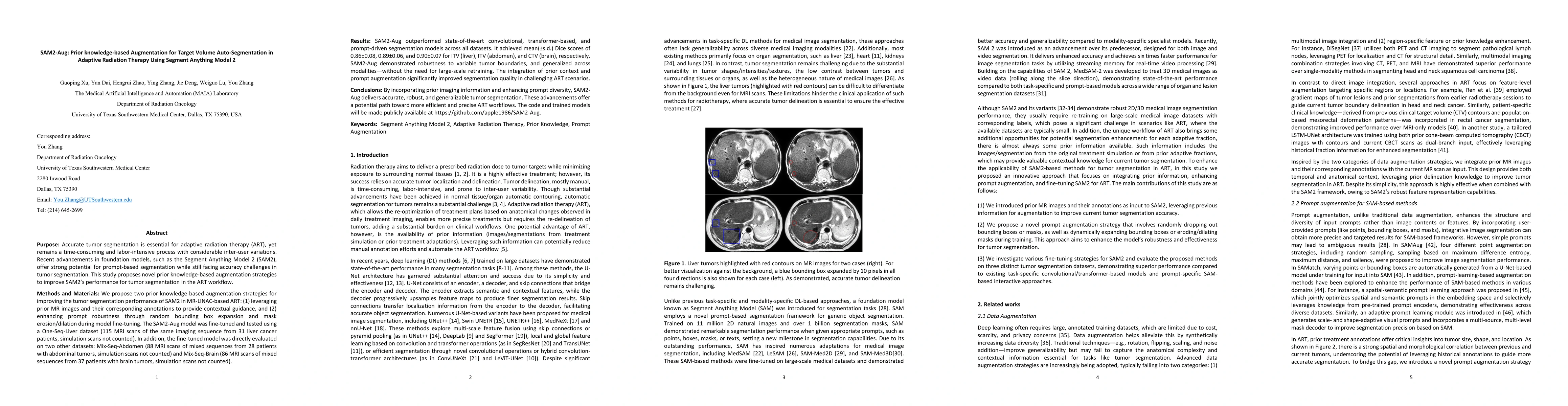 Thumbnail for SAM2-Aug: Prior knowledge-based Augmentation for Target Volume
  Auto-Segmentation in Adaptive Radiation Therapy Using Segment Anything Model
  2