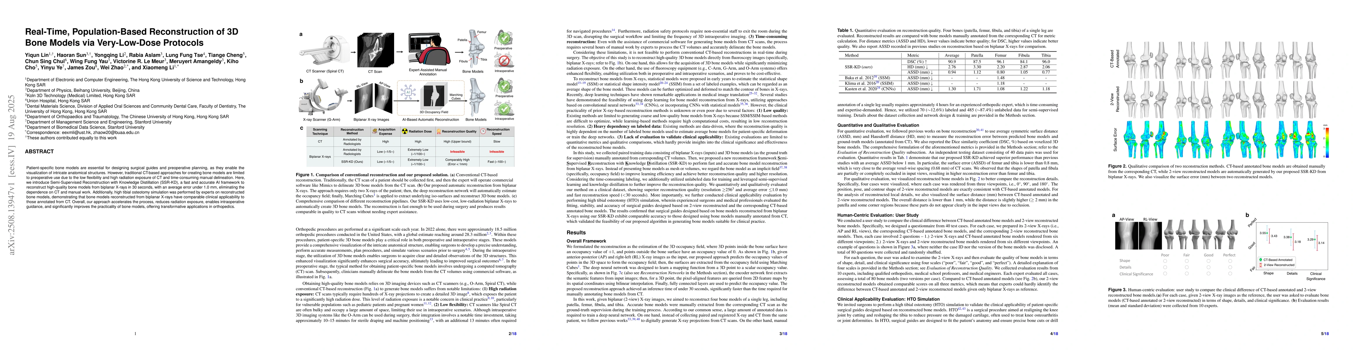 Thumbnail for Real-Time, Population-Based Reconstruction of 3D Bone Models via
  Very-Low-Dose Protocols