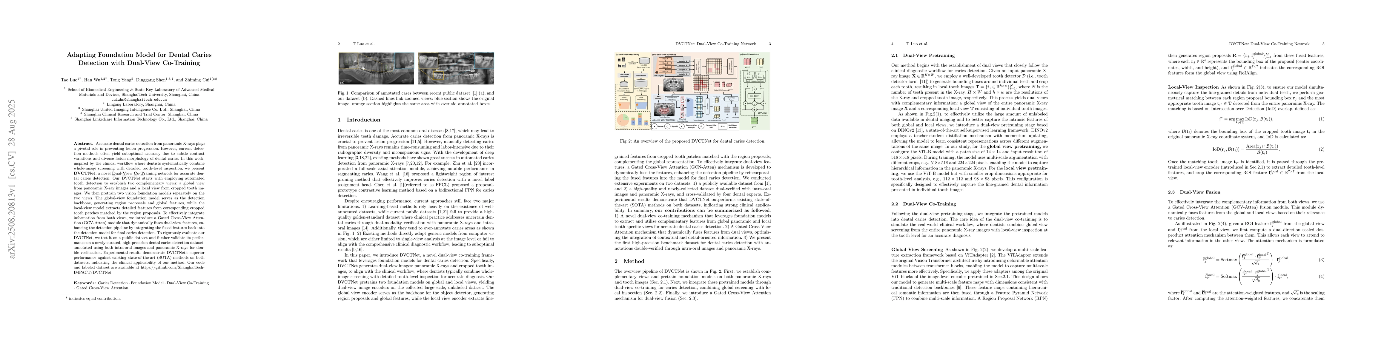 Thumbnail for Adapting Foundation Model for Dental Caries Detection with Dual-View
  Co-Training