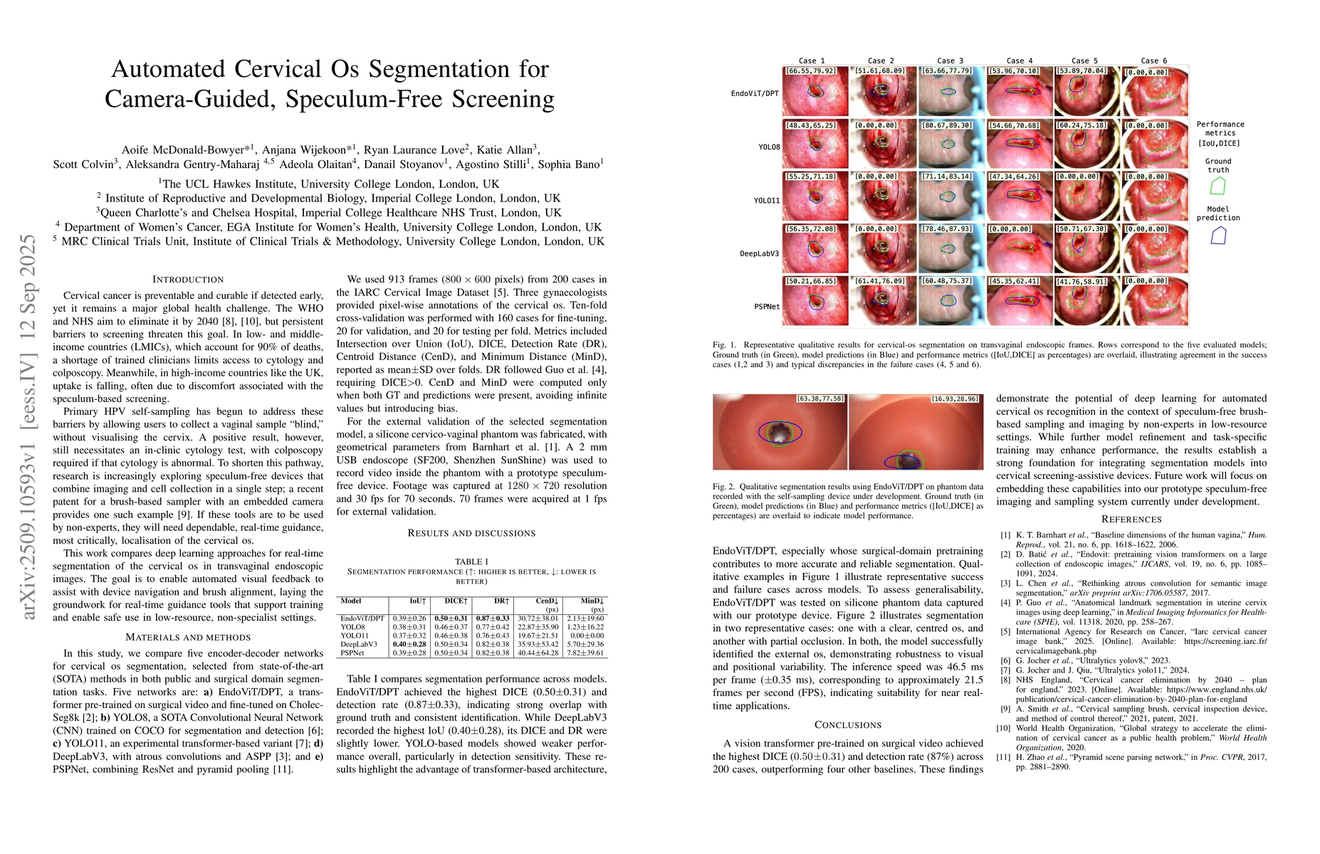 Thumbnail for Automated Cervical Os Segmentation for Camera-Guided, Speculum-Free
  Screening